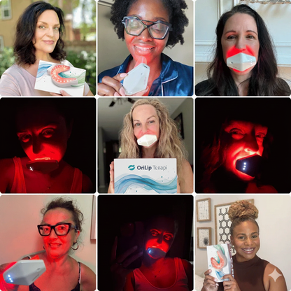 OriLip Terapi™| Çizgi Bakımı